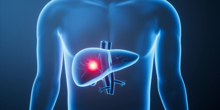 Fatty Liver Symptoms- 9 Warning Signs Your Liver Needs Attention