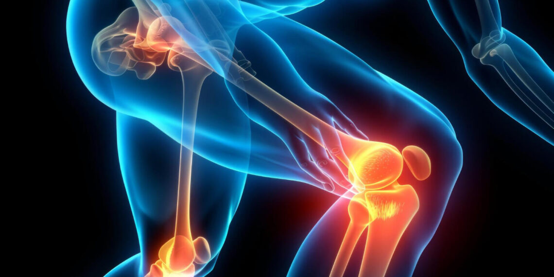 Signs of Low Vitamin D